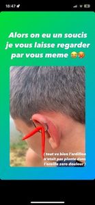 Oreilles Oreilles